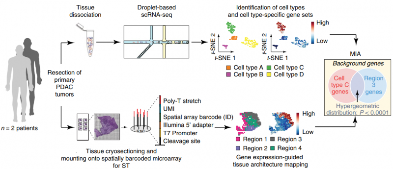 ST 联合 scRNA 揭示胰腺导管癌组织细胞类型及结构